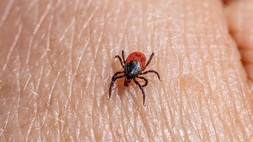 maladie de lyme